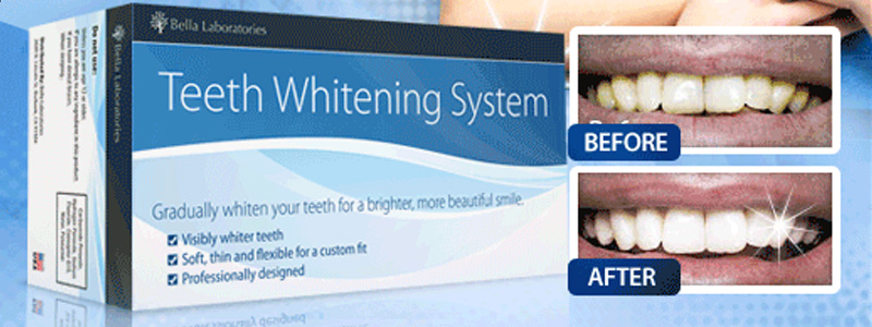 Review of Bella Labs Teeth Whitening